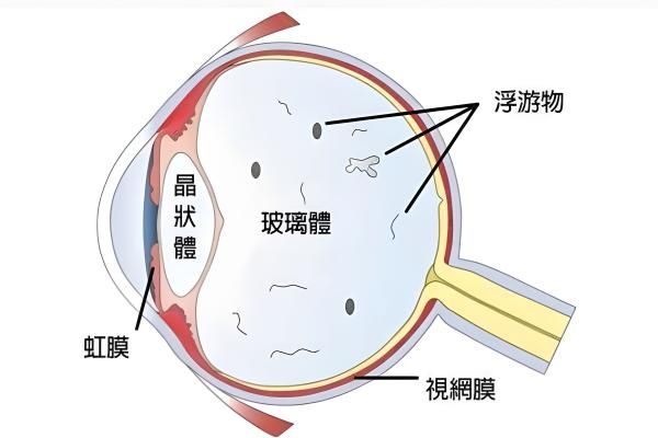 王乐今后巩膜加固术费用多少web508.com