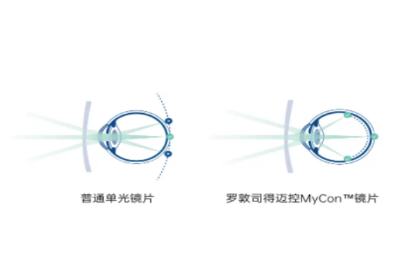 德国罗敦司得迈控离焦镜片注意事项web508.com