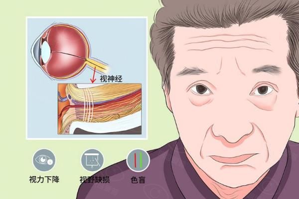 视神经萎缩有办法治疗吗？有,可根据不同症状采取不同方式治疗,另附注意事项web508.com