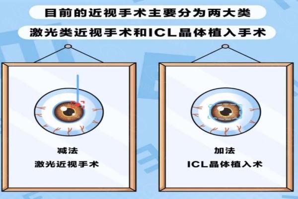 阜阳做近视手术多少钱？9000~34000元起，含半飞秒|全飞秒|icl价格！web508.com