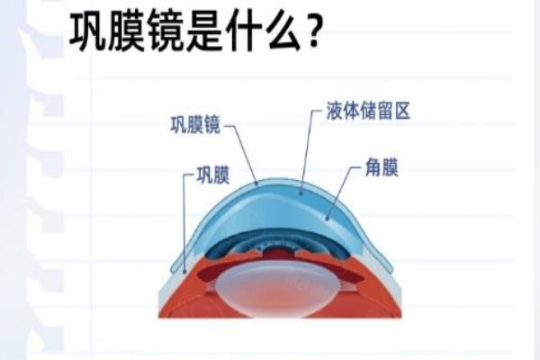 巩膜镜web508.com