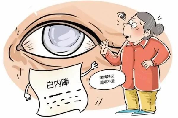 免费白内障手术怎么申请+政策解读，看这一篇就够了！web508.com