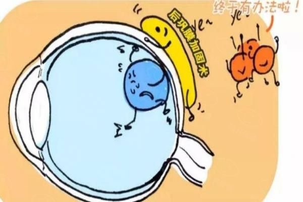 后巩膜加固术患者自述:视力改善,术后很满意,有后巩膜加固术全 国医生排名！web508.com