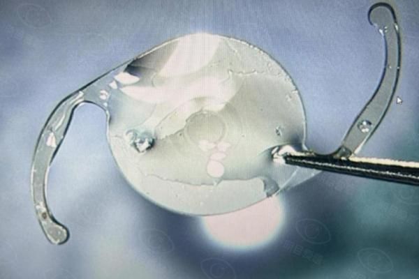 蔡司人工晶体集采2025新消息web508.com