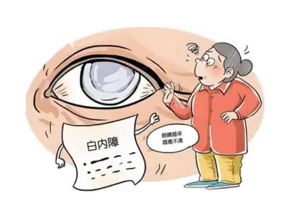2025年重庆白内障手术免费政策全解析:申请条件/定点医院/申请流程一步到位！www.web508.com