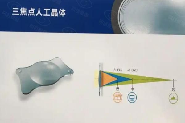 三焦人工晶体置换的弊端有哪些web508.com