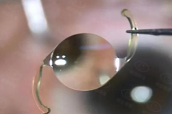 人工晶体手术可以报销吗web508.com